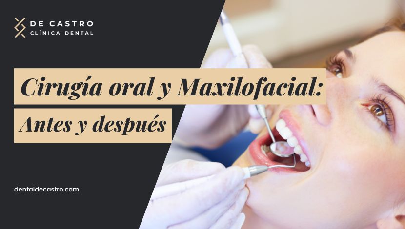 Cirugía maxilofacial antes y después: ¿Cómo quedará tu dentadura?