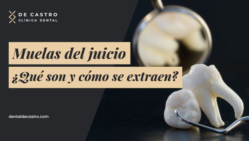 ¿Qué son las Muelas del Juicio y por qué deben extraerse?