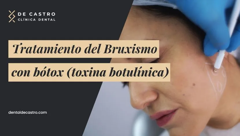 Bótox para el bruxismo: alivio efectivo para el dolor y el desgaste dental