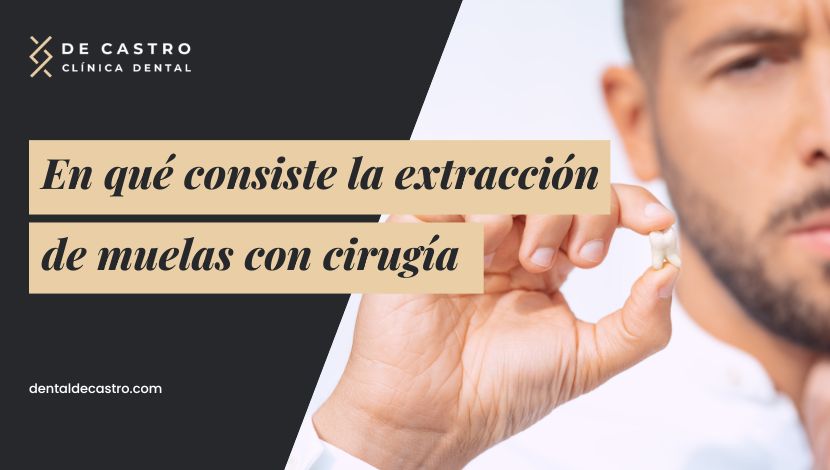 Extracción de la muela del juicio con cirugía maxilofacial: Guía paso a paso