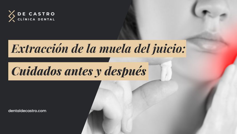 ¿Qué riesgos tiene la cirugía de extracción de muelas del juicio?
