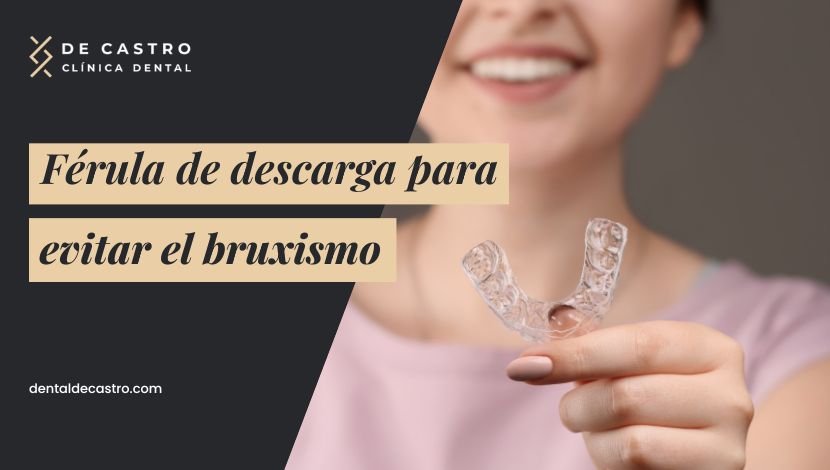 Férula de descarga para evitar el bruxismo: alivio y protección dental