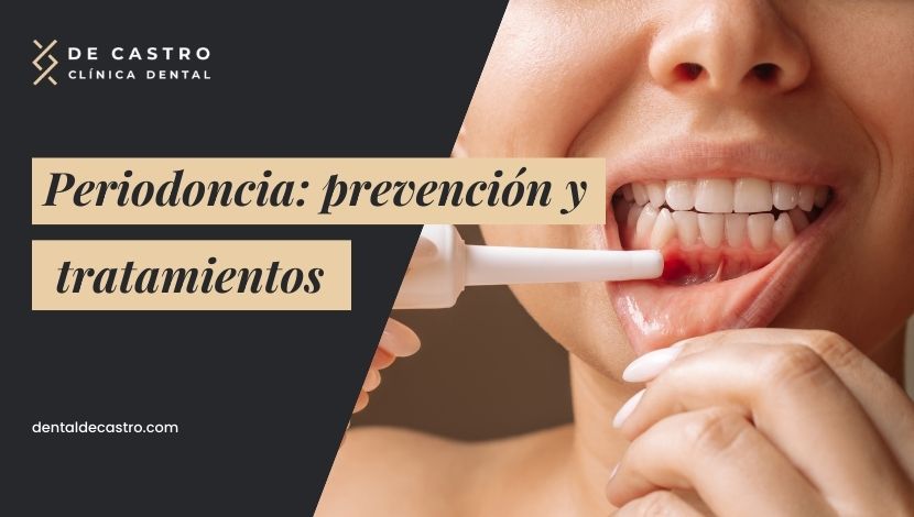 ¿Qué es la Periodoncia y en qué consiste este tratamiento dental?