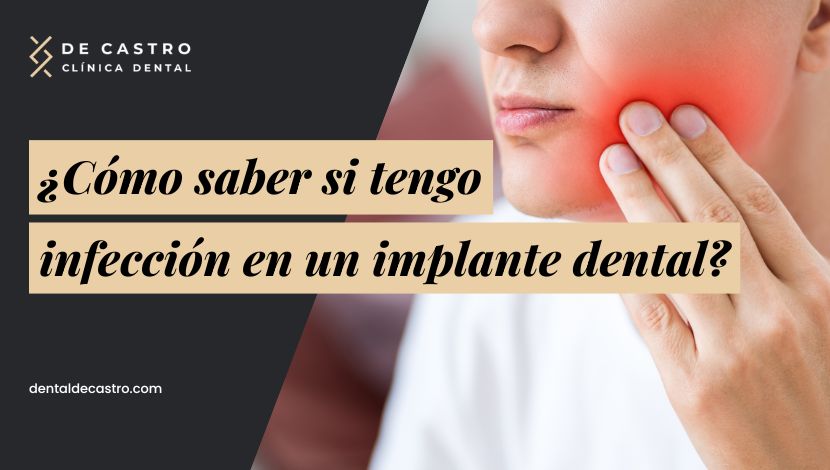 ¿Cómo saber si tengo una infección en un implante dental y qué hacer ante ese problema?