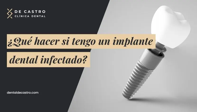 ¿Qué hacer si tengo un implante dental infectado?