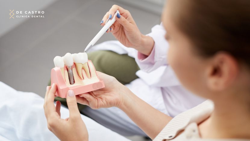 Implante dental en un solo dia