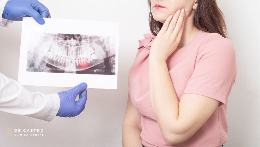 infecciones de los implantes dentales
