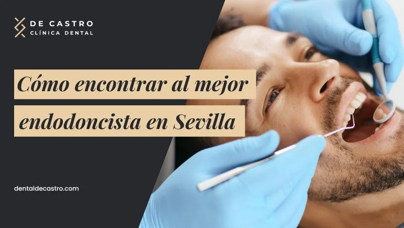Cómo encontrar al mejor endodoncista en Sevilla