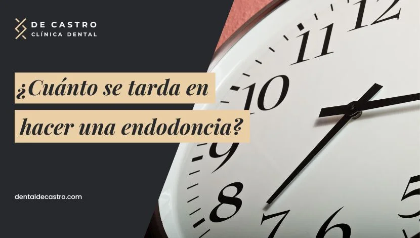 ¿Cuánto se tarda en hacer una endodoncia? Tiempo, factores y cuidados