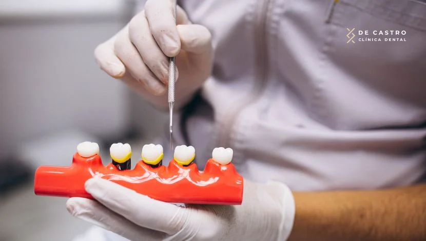 Endodoncia sin corona