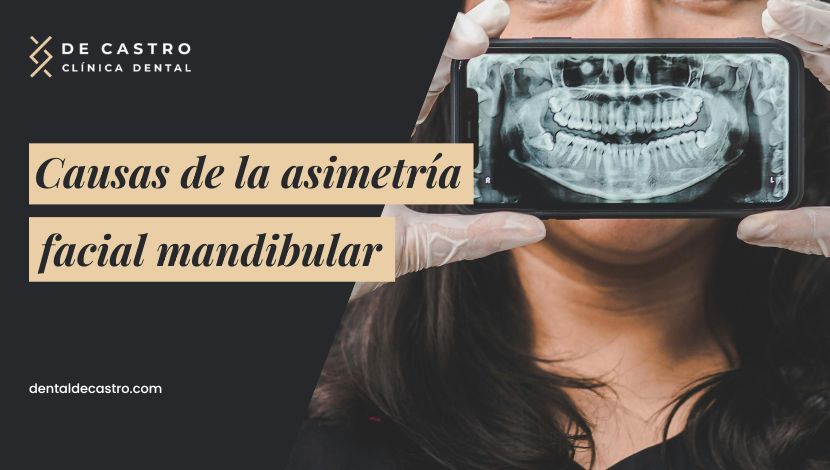 ¿Cuáles son las causas de la asimetría facial mandibular?