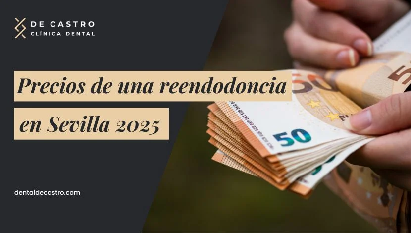 Precios de una reendodoncia en Sevilla: ¿cuánto cuesta realmente en 2025?