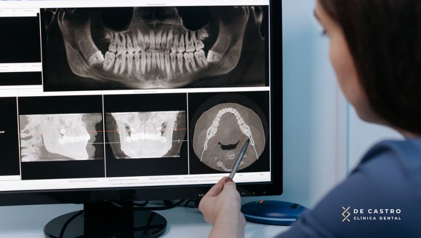 ¿Qué es la asimetría facial mandibular?