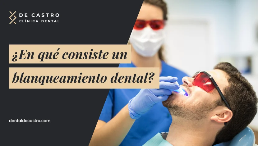 Blanqueamiento Dental en Sevilla