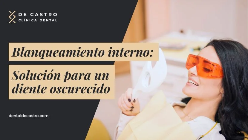Blanqueamiento interno para dientes oscurecidos