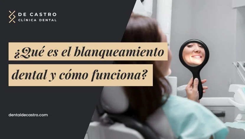 Qué es el blanqueamiento dental y cómo funciona