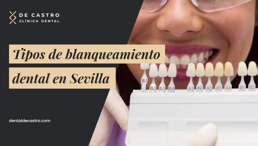 Tipos de blanqueamiento dental