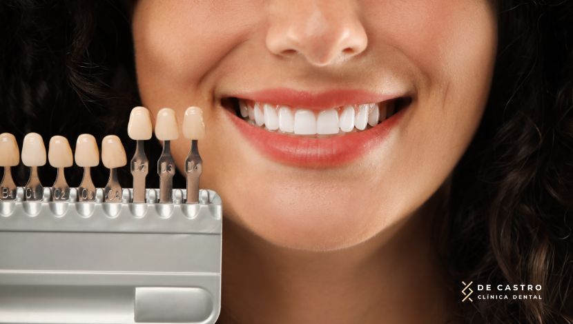 ¿Cuántos tonos se aclara un blanqueamiento dental?