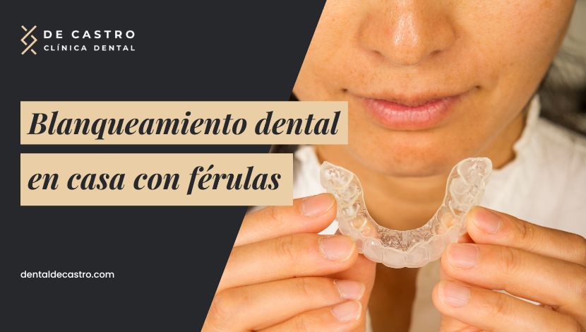 Blanqueamiento dental en casa con férulas: cómo funciona y cuánto tiempo se lleva