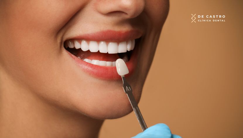 blanqueamiento-dental-dana-el-esmalte