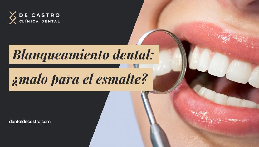 ¿El blanqueamiento dental es malo o daña el esmalte? Mitos y verdades