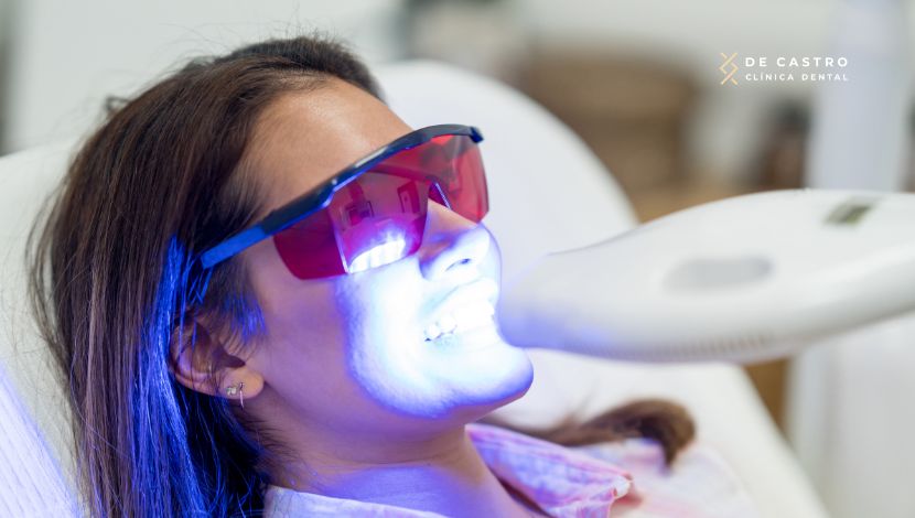 Pros y contras según el método de blanqueamiento dental