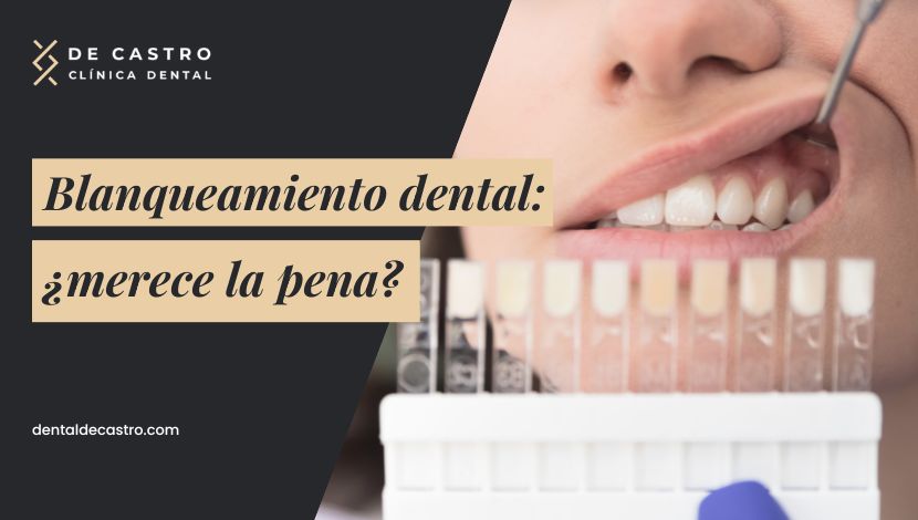 Ventajas y desventajas del blanqueamiento dental: ¿merece la pena?